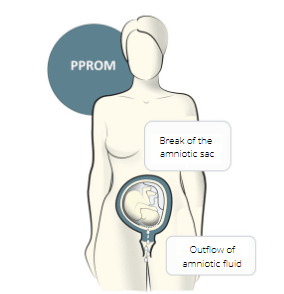 Bacterial Detection in Amniotic Fluid