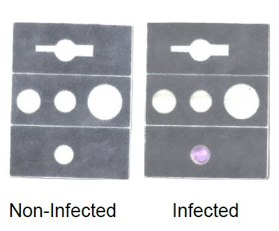 Foldable paper-based device for detection of infection in body fluids